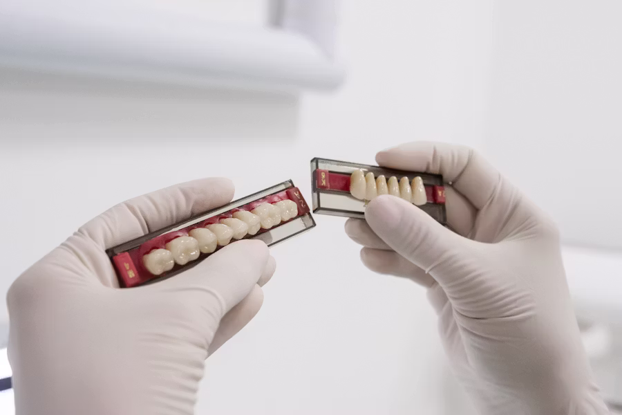 Cura dell'impianto dentale — Federico Campedelli Dentista