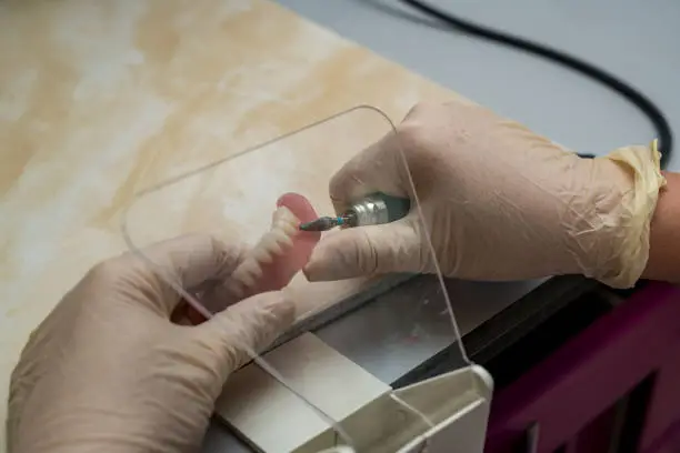 Implantologia — Federico Campedelli Dentista