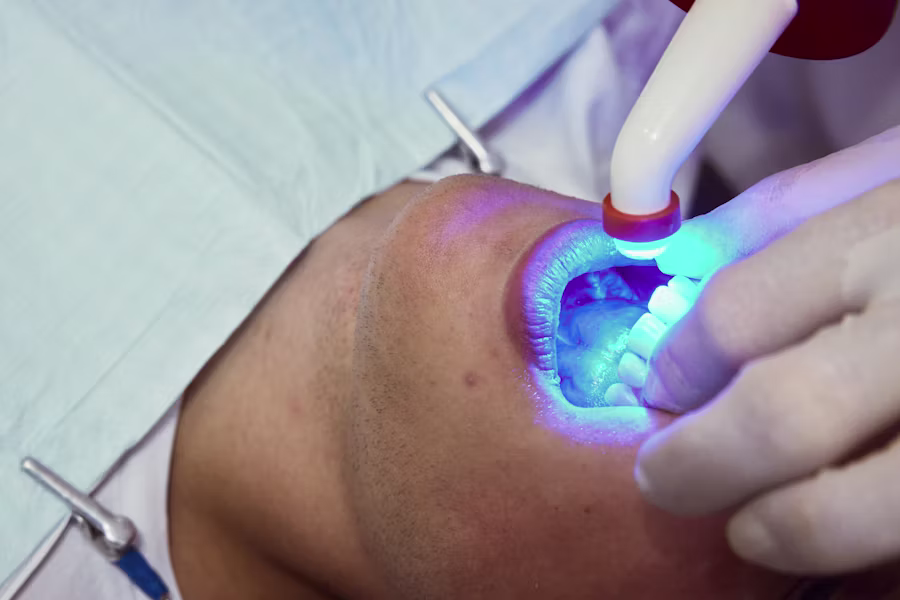 Sbiancamento denti professionale in studio — Federico Campedelli Dentista
